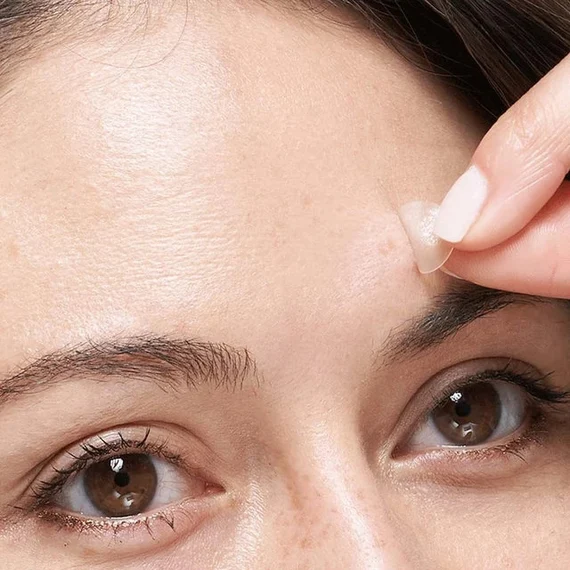 do pimple patches work