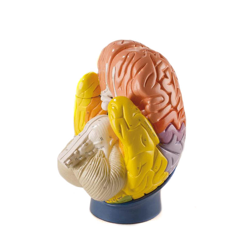 brain fog medical term