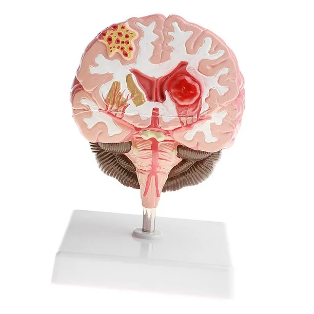 best food for brain fog